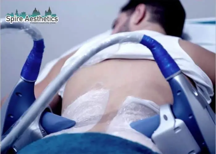 Man having fat freezing treatment done on love handles before a competitions Sonning to create a sculpted look.